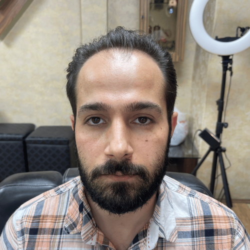 نمونه کار قبل و بعد گریم و آرایش داماد