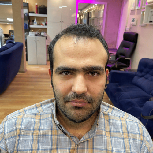 نمونه کار قبل و بعد گریم و آرایش داماد